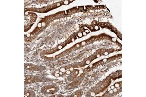 Immunohistochemical staining (Formalin-fixed paraffin-embedded sections) of human duodenum with KIAA1147 polyclonal antibody  shows strong cytoplasmic positivity in glandular cells. (DENND11/KIAA1147 anticorps)