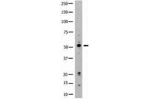 Image no. 1 for anti-Hemopoietic Cell Kinase (HCK) (N-Term) antibody (ABIN359984) (HCK anticorps  (N-Term))