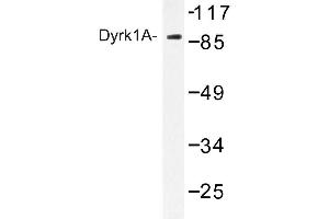 Image no. 1 for anti-Dual-Specificity tyrosine-(Y)-phosphorylation Regulated Kinase 1A (DYRK1A) antibody (ABIN272227) (DYRK1A anticorps)
