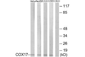 Immunohistochemistry analysis of paraffin-embedded human liver carcinoma tissue using COX17 antibody. (COX17 anticorps)