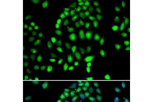 Immunofluorescence analysis of MCF-7 cells using PARP3 Polyclonal Antibody (PARP3 anticorps)