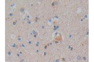 Detection of PTGES2 in Human Brain Tissue using Polyclonal Antibody to Prostaglandin E Synthase 2 (PTGES2)