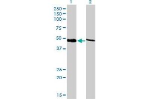 Western Blot analysis of PSMC4 expression in transfected 293T cell line by PSMC4 monoclonal antibody (M01), clone 3G8.