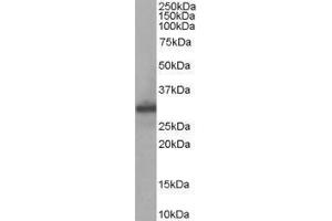 Western Blotting (WB) image for anti-Four and A Half LIM Domains 1 (FHL1) antibody (ABIN2473617) (FHL1 anticorps)