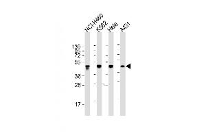 All lanes : Anti-CYK18 Antibody (C-term) at 1:2000 dilution Lane 1: NCI- whole cell lysate Lane 2: K562 whole cell lysate Lane 3: Hela whole cell lysate Lane 4: A431 whole cell lysate Lysates/proteins at 20 μg per lane.