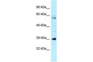 Image no. 1 for anti-Hydroxysteroid (17-Beta) Dehydrogenase 8 (HSD17B8) (AA 51-100) antibody (ABIN6747948) (HSD17B8 anticorps  (AA 51-100))