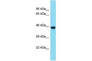 Western Blotting (WB) image for anti-N-Acetylated alpha-Linked Acidic Dipeptidase-Like 2 (NAALADL2) (C-Term) antibody (ABIN2790659) (NAALADL2 anticorps  (C-Term))