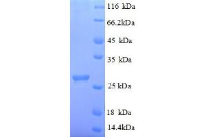 SDS-PAGE (SDS) image for Abscisic Acid Receptor PYL1 (PYL1) (AA 8-221), (partial) protein (His tag) (ABIN5712892)