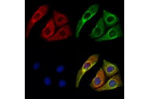 ABIN6261602 and ABIN6273043 staining Hela cells by IF/ICC. (ERO1LB anticorps  (Internal Region))