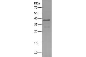 Western Blotting (WB) image for Podocalyxin-Like (PODXL) (AA 23-340) protein (His tag) (ABIN7124498)