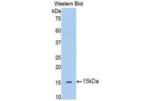 Western blot analysis of the recombinant protein. (IL13RA2 anticorps  (AA 238-334))