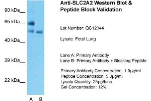 Host: Rabbit  Target Name: SLC2A2  Sample Tissue: Fetal LungLane A:  Primary Antibody Lane B:  Primary Antibody + Blocking Peptide Primary Antibody Concentration: 1 µg/mL Peptide Concentration: 5 µg/mL Lysate Quantity: 41 µg/laneGel Concentration:. (SLC2A2 anticorps  (N-Term))