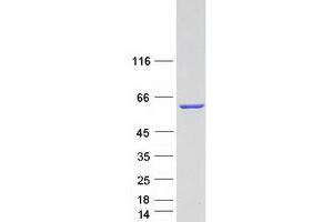 Validation with Western Blot