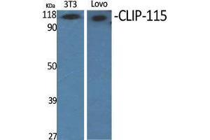 Western Blot (WB) analysis of specific cells using CLIP-115 Polyclonal Antibody. (CLIP2 anticorps  (C-Term))