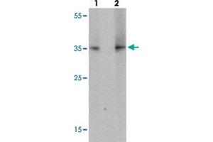 Western blot analysis of TLX1 in mouse spleen tissue with TLX1 polyclonal antibody  at (lane 1) 1 ug/mL and (lane 2) 2 ug/mL.