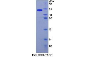 SDS-PAGE analysis of Human AMIGO1 Protein. (AMIGO1 Protéine)