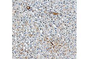 IHC analysis of Pecam1 using anti-Pecam1 antibody (ABIN7601672). (CD31 anticorps  (AA 41-491))