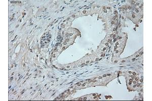Immunohistochemical staining of paraffin-embedded lung tissue using anti-NEUROG1mouse monoclonal antibody. (Neurogenin 1 anticorps)