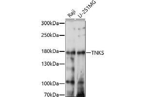 Western blot analysis of extracts of various cell lines, using TNKS antibody (ABIN7270725) at 1:1000 dilution.