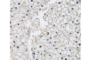 Immunohistochemistry of paraffin-embedded Human liver using CDK7 Polyclonal Antibody at dilution of 1:150 (40x lens).