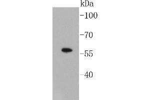 Lane 1: A549 Cell lysates, probed with Smad3 (3D1) Monoclonal Antibody  at 1:1000 overnight at 4˚C.