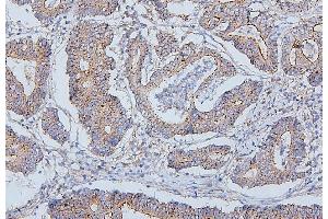 IHC analysis of PDCD6IP using anti-PDCD6IP antibody (ABIN7600490). (ALIX anticorps  (AA 2-330))