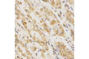 Immunohistochemistry of paraffin-embedded human stomach using GGA2 Antibody.