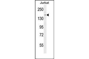 Western blot analysis of PPRC1 Antibody (C-term) in Jurkat cell line lysates (35ug/lane).