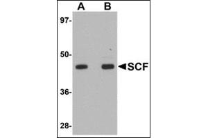 Western blot analysis of SCF in rat brain tissue lysate with this product at (A) 1 and (B) 2 μg/ml. (KIT Ligand anticorps  (Center))