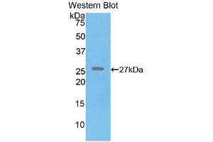 Western blot analysis of recombinant Human ELN. (Elastin anticorps  (AA 392-645))