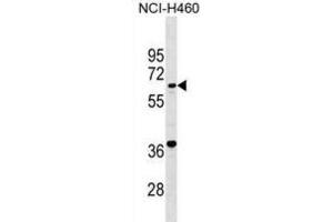 Western Blotting (WB) image for anti-PET112 Homolog (PET112) antibody (ABIN2999660) (PET112L anticorps)
