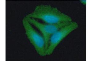 ICC/IF analysis of STOM in HeLa cells line, stained with DAPI (Blue) for nucleus staining and monoclonal anti-human STOM antibody (1:100) with goat anti-mouse IgG-Alexa fluor 488 conjugate (Green).