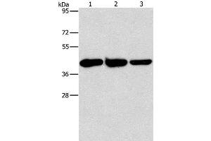 Western Blot analysis of Human normal liver tissue, Mouse brain and heart tissue using GOT1 Polyclonal Antibody at dilution of 1:1600 (GOT1 anticorps)