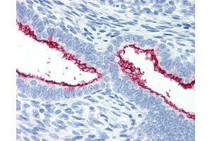 Anti-MUC16 / CA-125 antibody IHC of human uterus. (MUC16 anticorps)