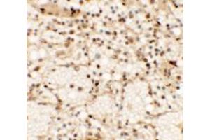 Immunohistochemistry (IHC) image for anti-C-Type Lectin Domain Family 7, Member A (CLEC7A) (Middle Region) antibody (ABIN1030907) (CLEC7A anticorps  (Middle Region))