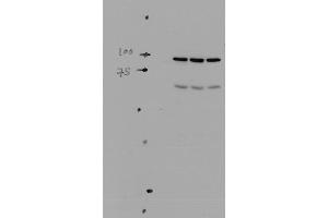 Western blot analysis of Mouse kidney tissue lysates showing detection of ENaC protein using Rabbit Anti-ENaC Polyclonal Antibody (ABIN863202).