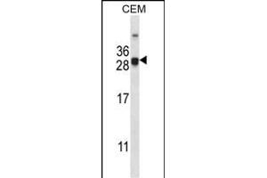 CIDEA Antibody (C-term) (ABIN657978 and ABIN2846924) western blot analysis in CEM cell line lysates (35 μg/lane).