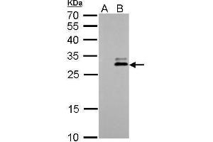 WB Image KLK7 antibody detects KLK7 protein by Western blot analysis.