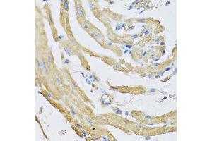 Immunohistochemistry of paraffin-embedded mouse heart using SFRP4 antibody at dilution of 1:100 (40x lens). (SFRP4 anticorps)