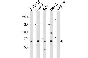 All lanes : Anti-MeCP2 Antibody at 1:2000 dilution Lane 1: SH-SY5Y whole cell lysates Lane 2: Jurkat whole cell lysates Lane 3: A431 whole cell lysates Lane 4: HepG2 whole cell lysates Lane 5: NIH/3T3 whole cell lysates Lysates/proteins at 20 μg per lane. (MECP2 anticorps  (AA 400-428))