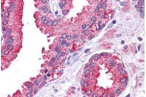 Human Prostate: Formalin-Fixed, Paraffin-Embedded (FFPE)