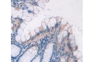 IHC-P analysis of Mouse Tissue, with DAB staining. (BMP2 anticorps  (AA 281-394))
