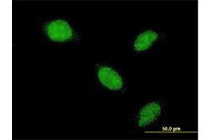 Immunofluorescence of monoclonal antibody to AHR on HeLa cell. (Aryl Hydrocarbon Receptor anticorps  (AA 721-820))