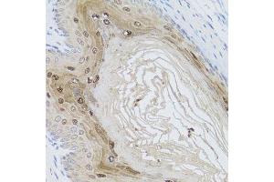 Immunohistochemistry of paraffin-embedded mouse stomach using AMBRA1 antibody.
