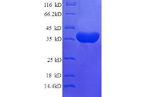SDS-PAGE (SDS) image for Islet Cell Autoantigen 1, 69kDa (ICA1) (AA 1-268), (partial) protein (His tag) (ABIN5709691)