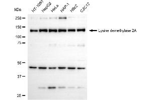 Western blotting analysis using lysine demethylase 2A antibody (ABIN7799299).