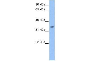 Beta Lactamase antibody used at 1 ug/ml to detect target protein. (LACTB anticorps  (Middle Region))