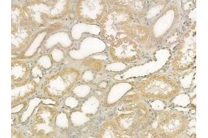 ABIN6265566 and ABIN6276558 at 1/100 staining human normal kidney tissue by IHC-P. (TICAM1 anticorps  (Internal Region))