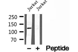 Western blot analysis of extracts of Jurkat cells, using MICAL1 antibody. (MICAL1 anticorps  (Internal Region))