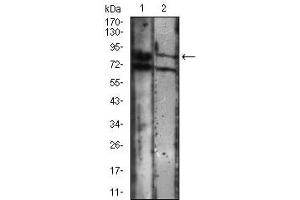 Western blot analysis using CDH16 mouse mAb against A431 (1), Jurkat (2) cell lysate. (Cadherin-16 anticorps)